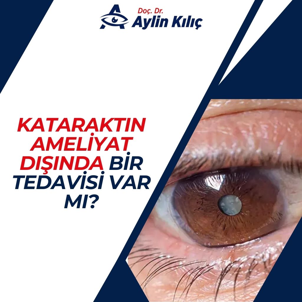 Kataraktın Ameliyat Dışında Bir Tedavisi Var mı