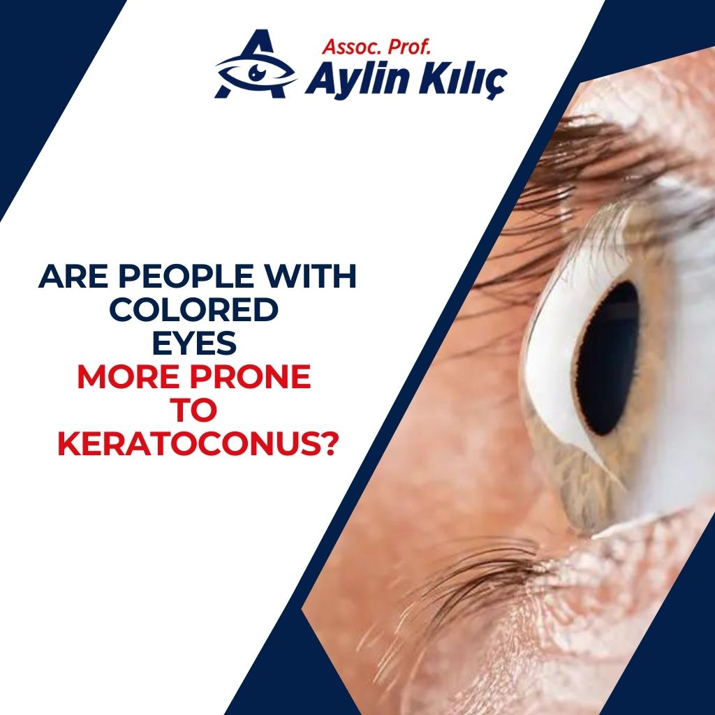 Are People with Colored Eyes More Prone to Keratoconus
