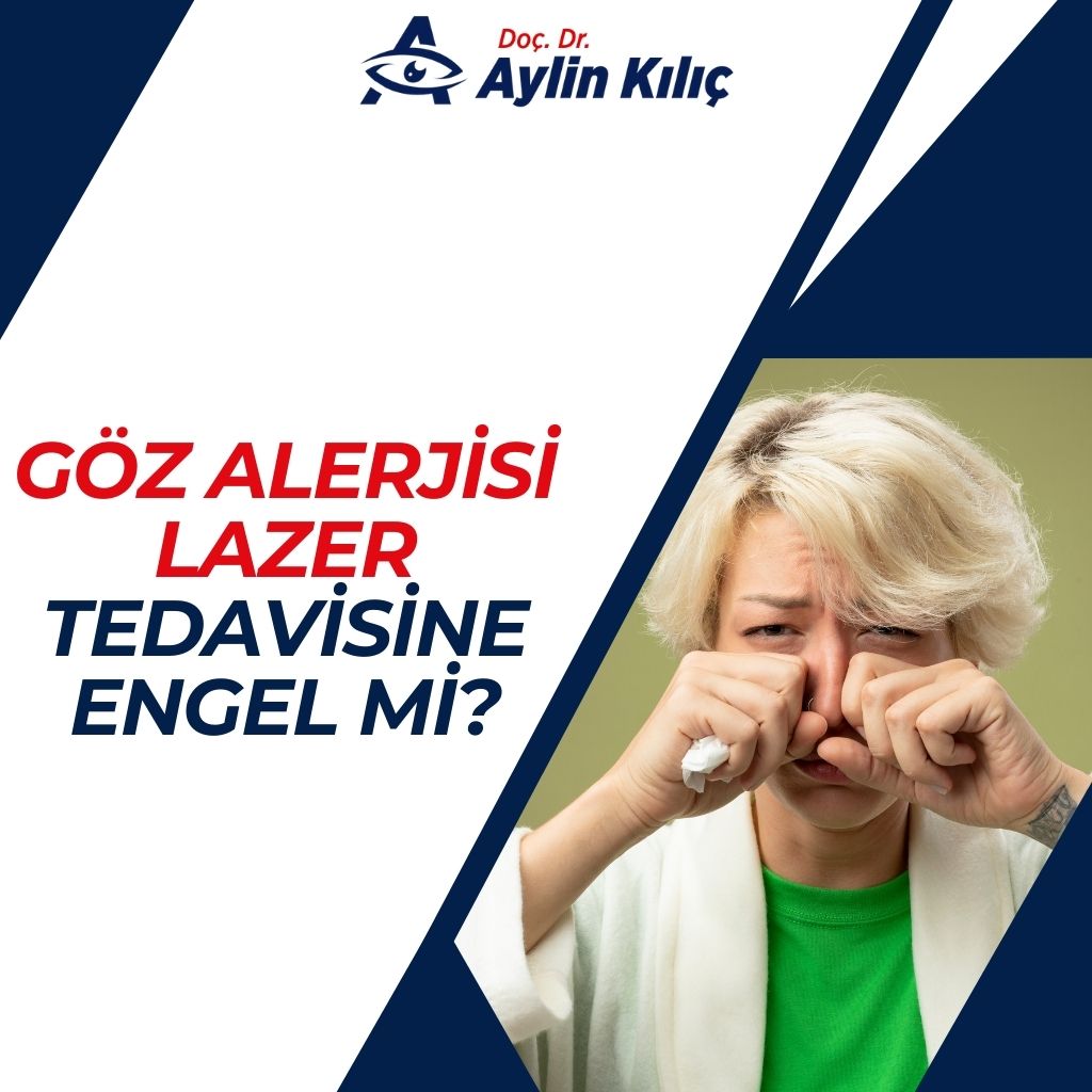 Goz Alerjisi Lazer Tedavisine Engel mi 3