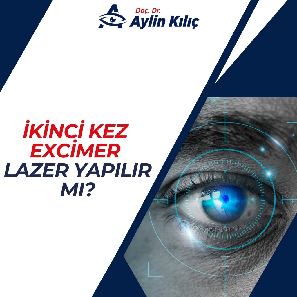 Ikinci Kez Excimer Lazer Yapilir mi