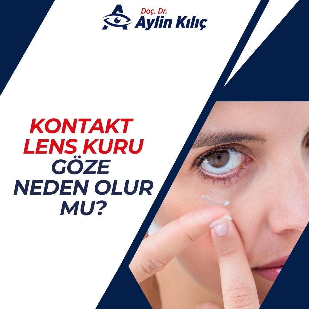 Kontakt Lens Kuru Goze Neden Olur muTR