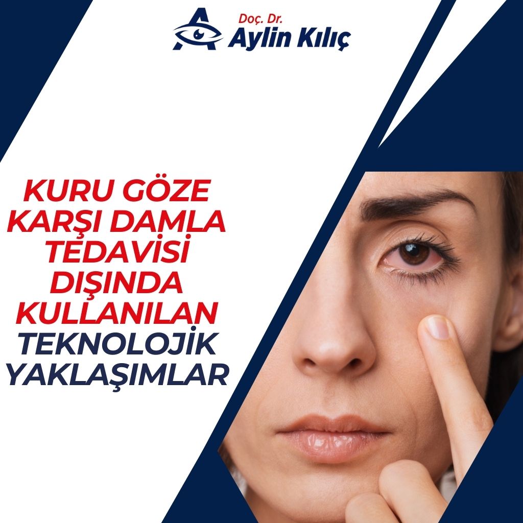 Kuru Göze Karşı Damla Tedavisi Dışında Kullanılan Teknolojik Yaklaşımlar