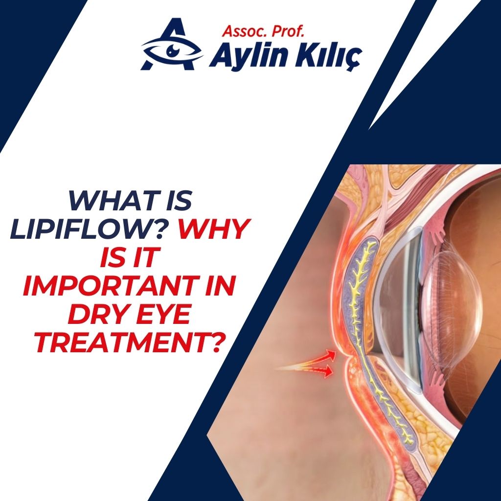 What is Lipiflow Why is it Important in Dry Eye Treatment 2