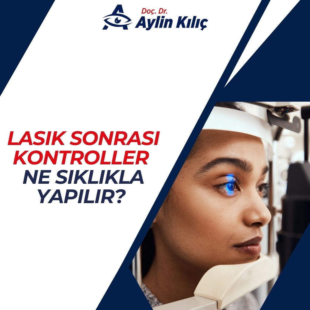 LASIK Sonrası Kontroller Ne Sıklıkla Yapılır 