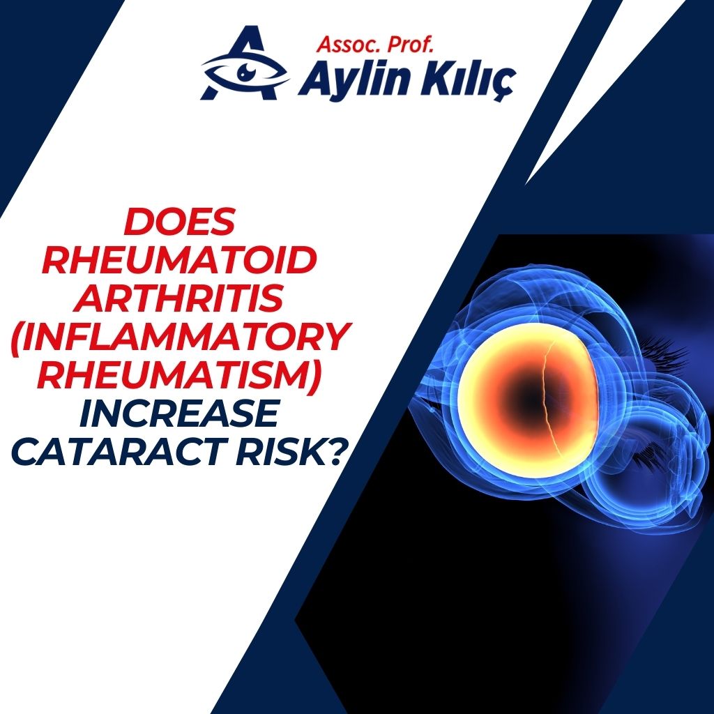 Does Rheumatoid Arthritis (Inflammatory Rheumatism) Increase Cataract Risk