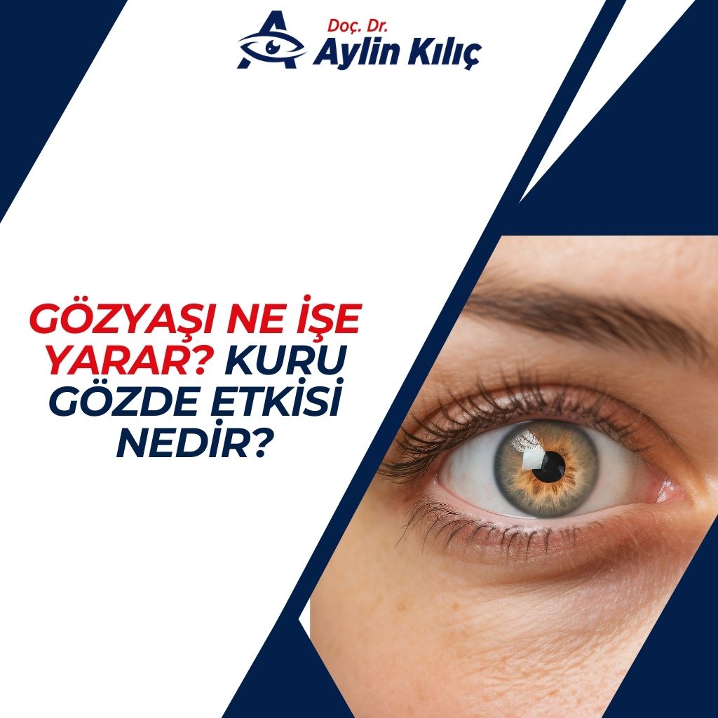 Gozyasi Ne Ise Yarar Kuru Gozde Etkisi Nedir1