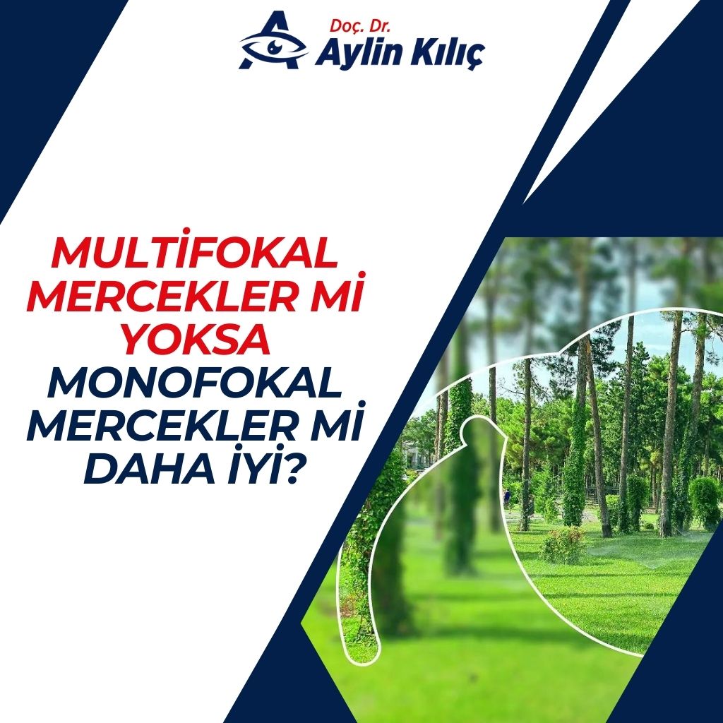 Multifokal Mercekler mi Yoksa Monofokal Mercekler mi Daha İyi