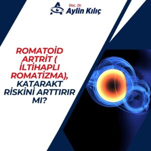 Romatoid Artrit ( İltihaplı Romatizma), Katarakt Riskini Arttırır mı