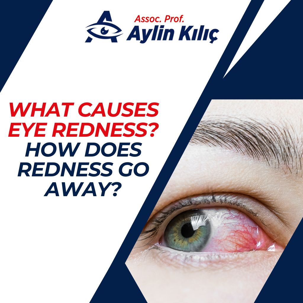 What Causes Eye Redness How Does Redness Go Away