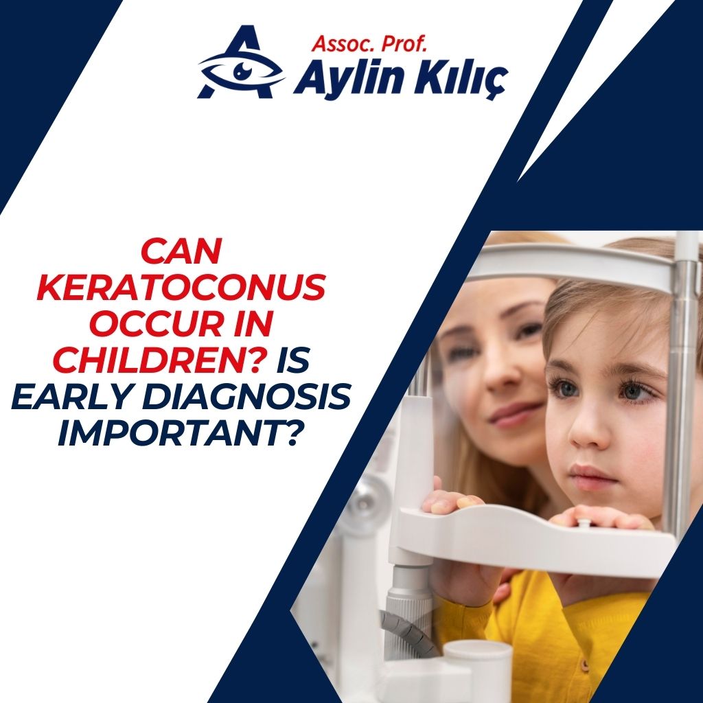 Can Keratoconus Occur in Children Is Early Diagnosis Important