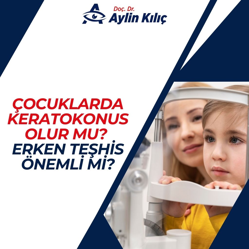 Çocuklarda Keratokonus Olur mu Erken Teşhis Önemli mi