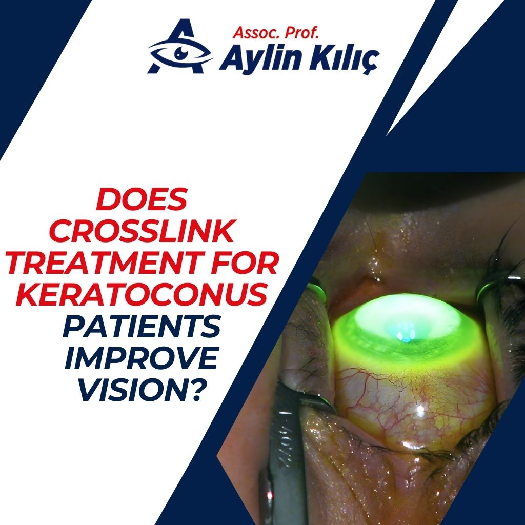 Does Crosslink Treatment for Keratoconus Patients Improve Vision