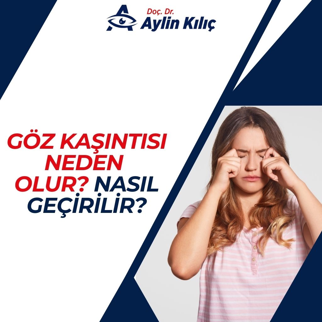 Göz Kaşıntısı Neden Olur Nasıl Geçirilir