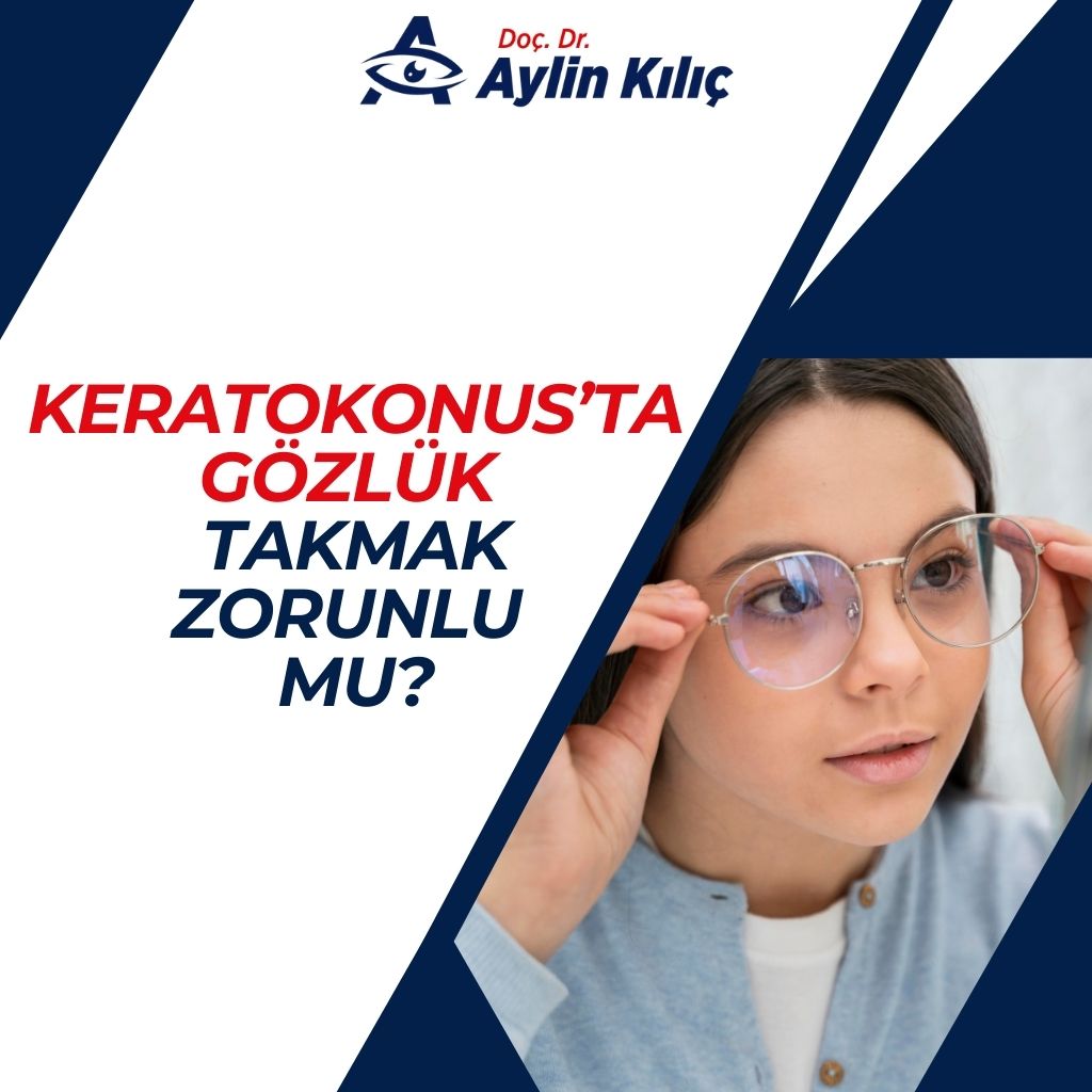 Keratokonusta Gozluk Takmak Zorunlu mu 2