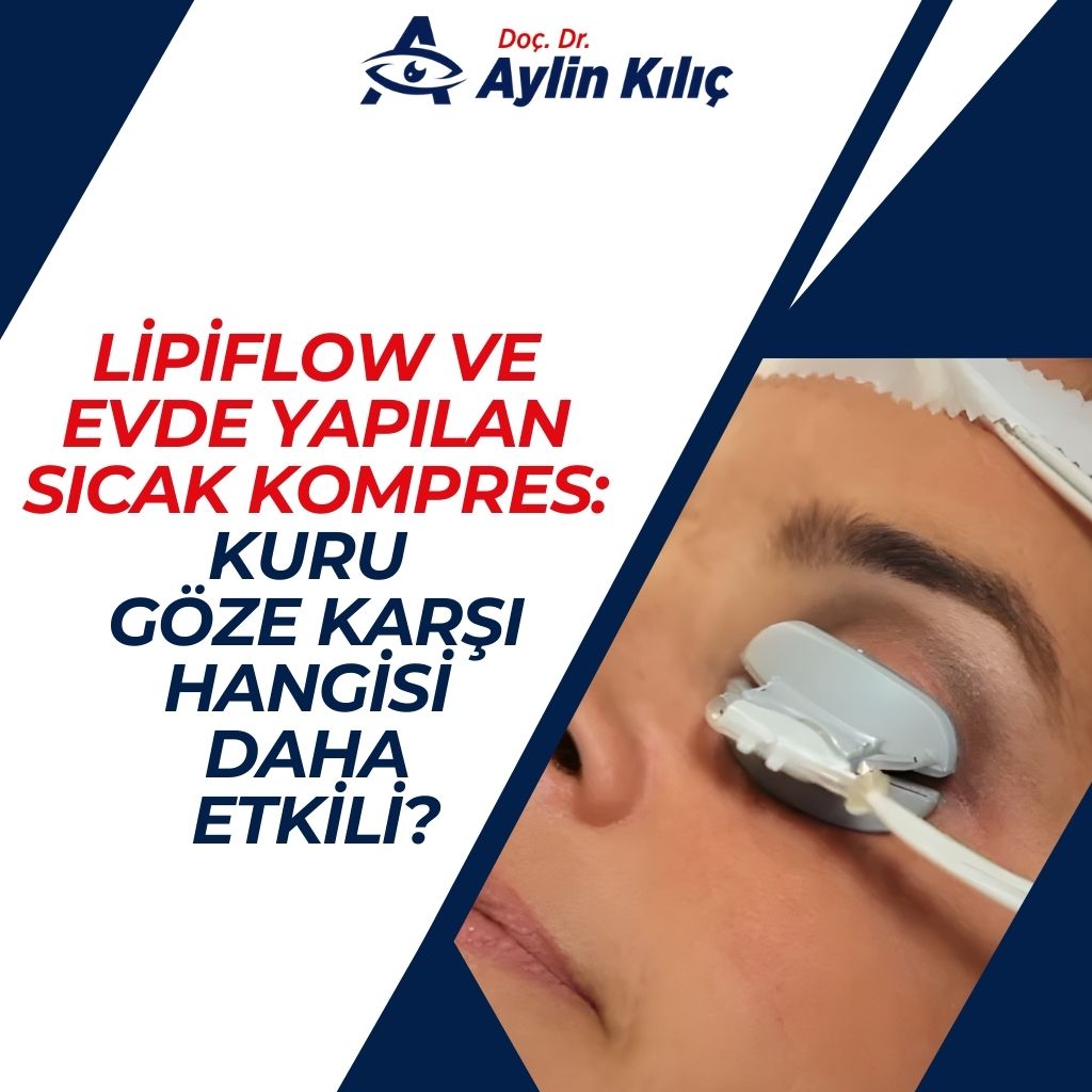 LipiFlow ve Evde Yapılan Sıcak Kompres Kuru Göze Karşı Hangisi Daha Etkili