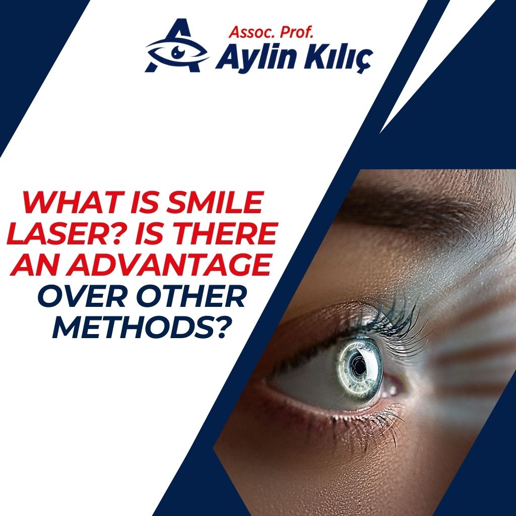 What is Smile Laser Is there an advantage over other methods