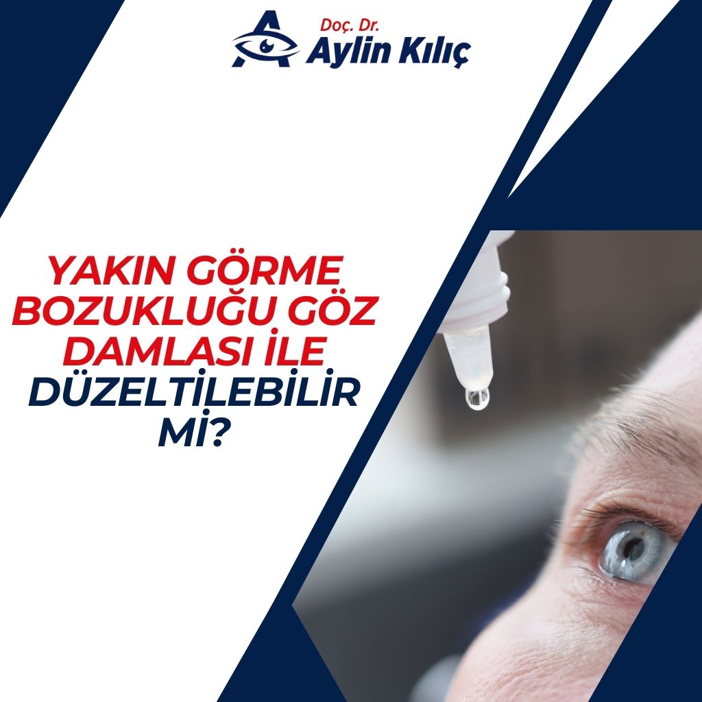 Yakin Gorme Bozuklugu Goz Damlasi ile Duzeltilebilir mi 4