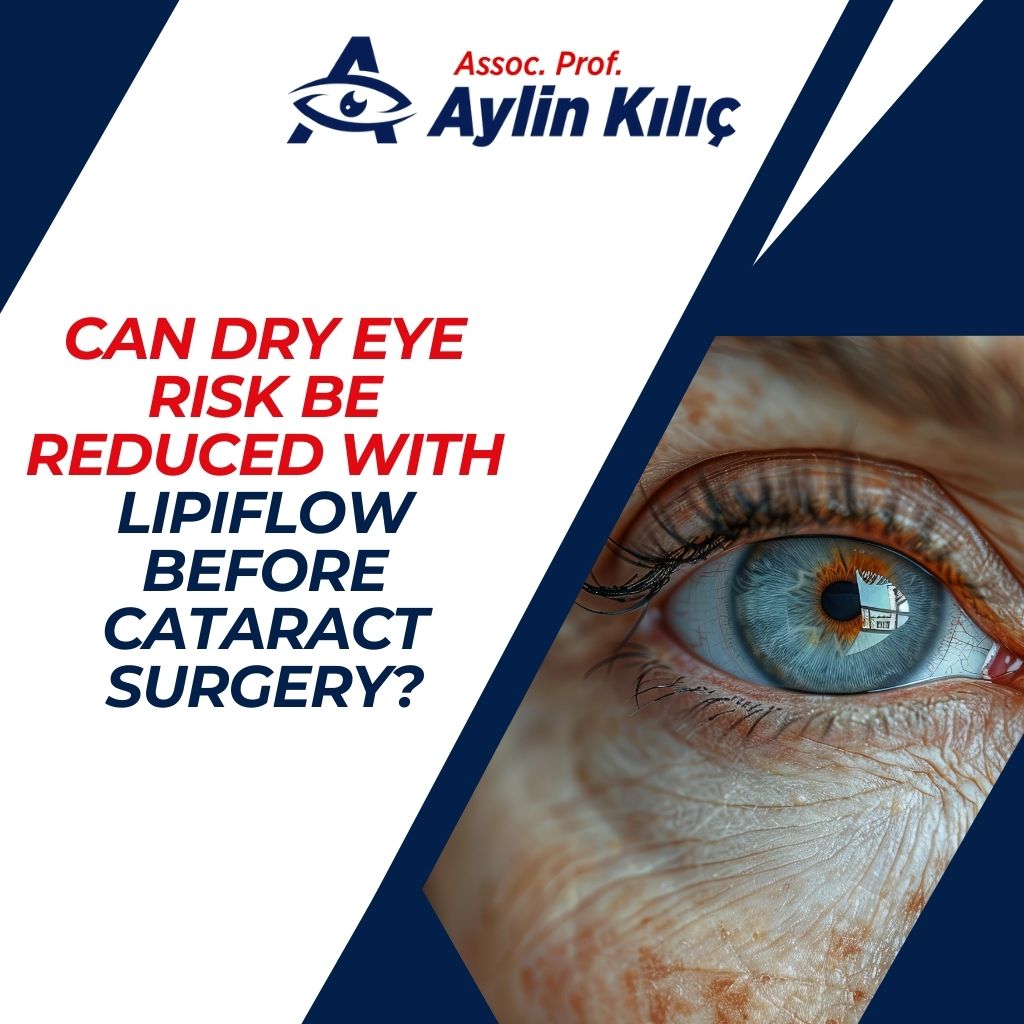 Can Dry Eye Risk be Reduced with Lipiflow Before Cataract Surgery