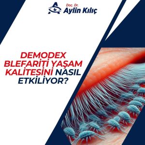 Demodex Blefariti Yaşam Kalitesini Nasıl Etkiliyor