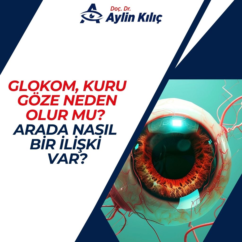 Glokom, Kuru Göze Neden Olur mu Arada Nasıl Bir İlişki Var