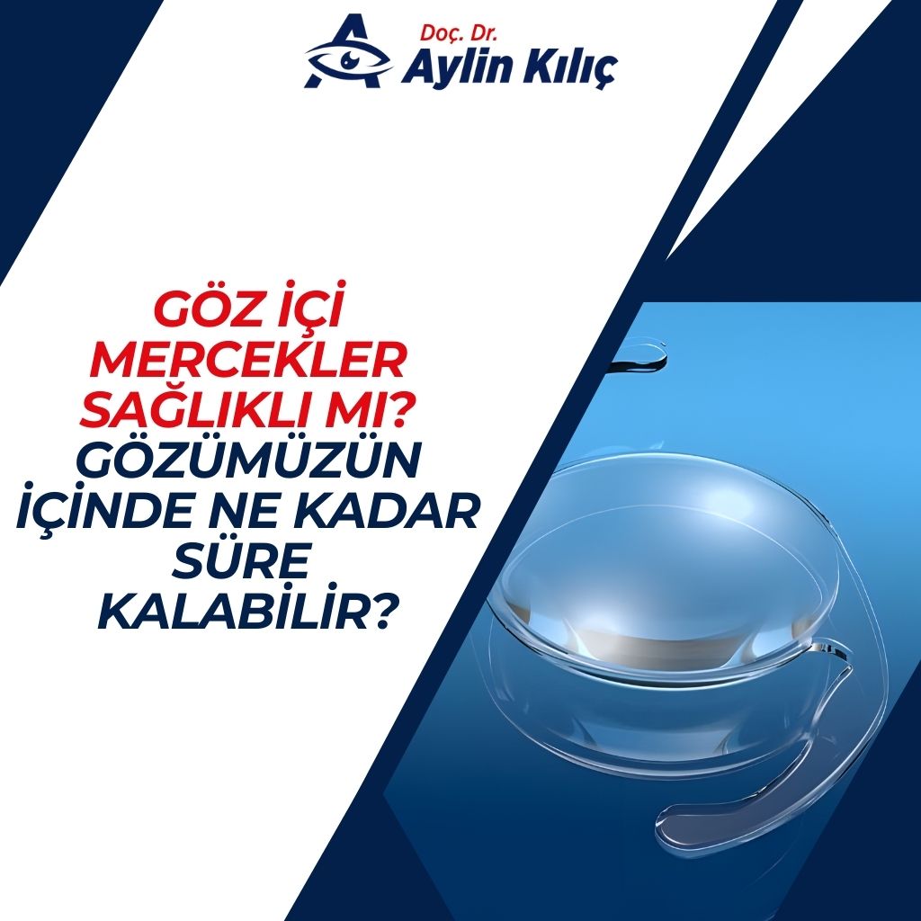 Göz İçi Mercekler Sağlıklı mı Gözümüzün İçinde Ne Kadar Süre Kalabilir