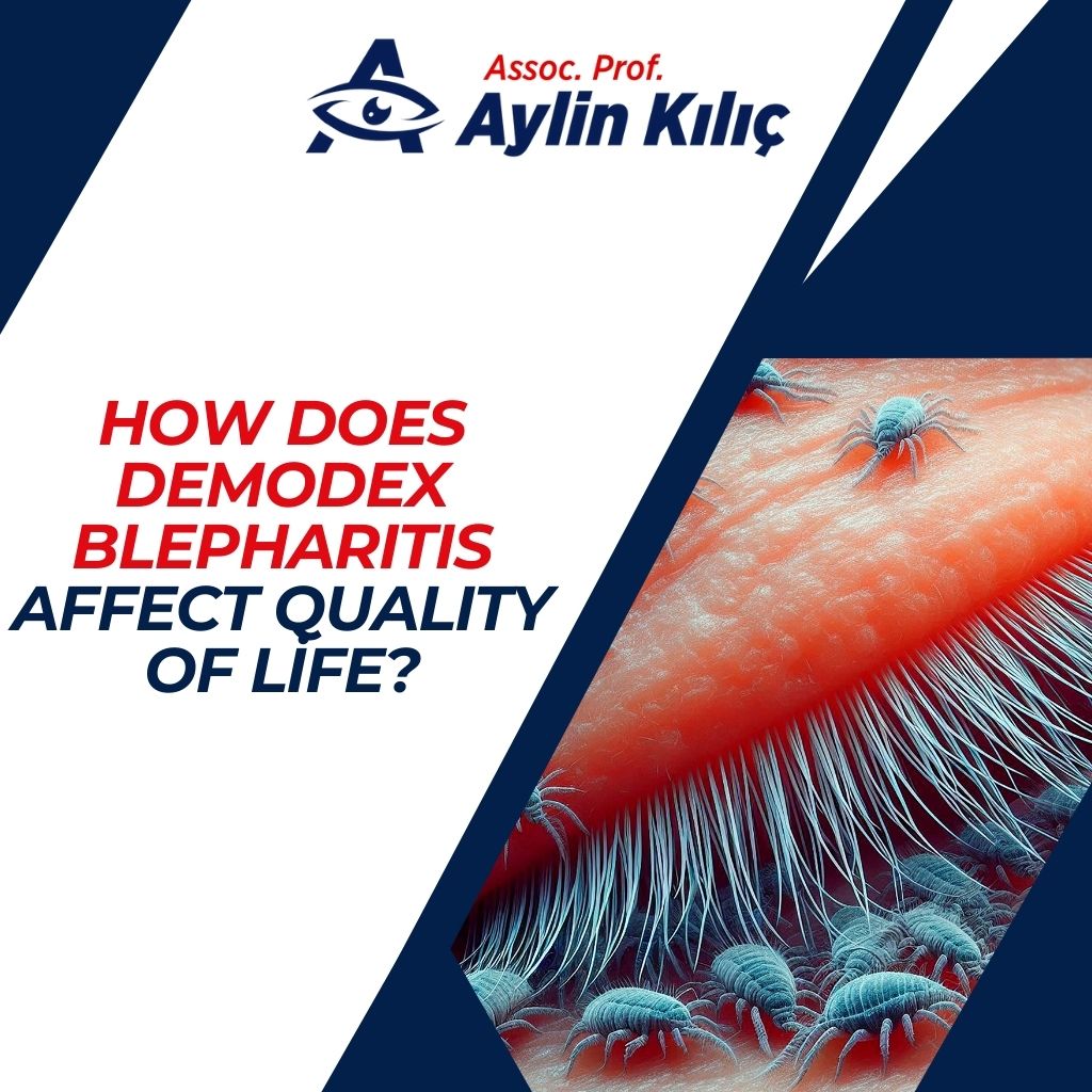 How Does Demodex Blepharitis Affect Quality of Life