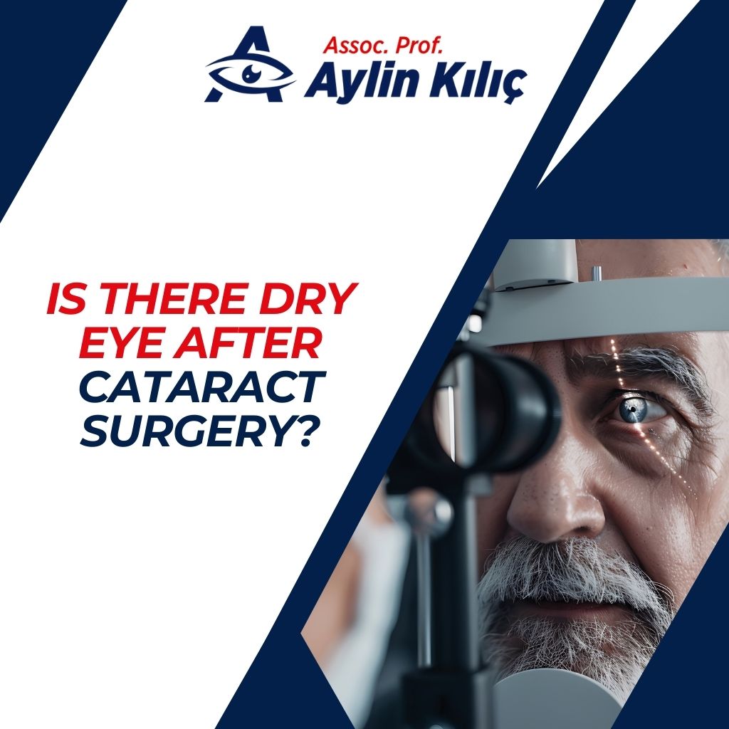 Is There Dry Eye After Cataract Surgery