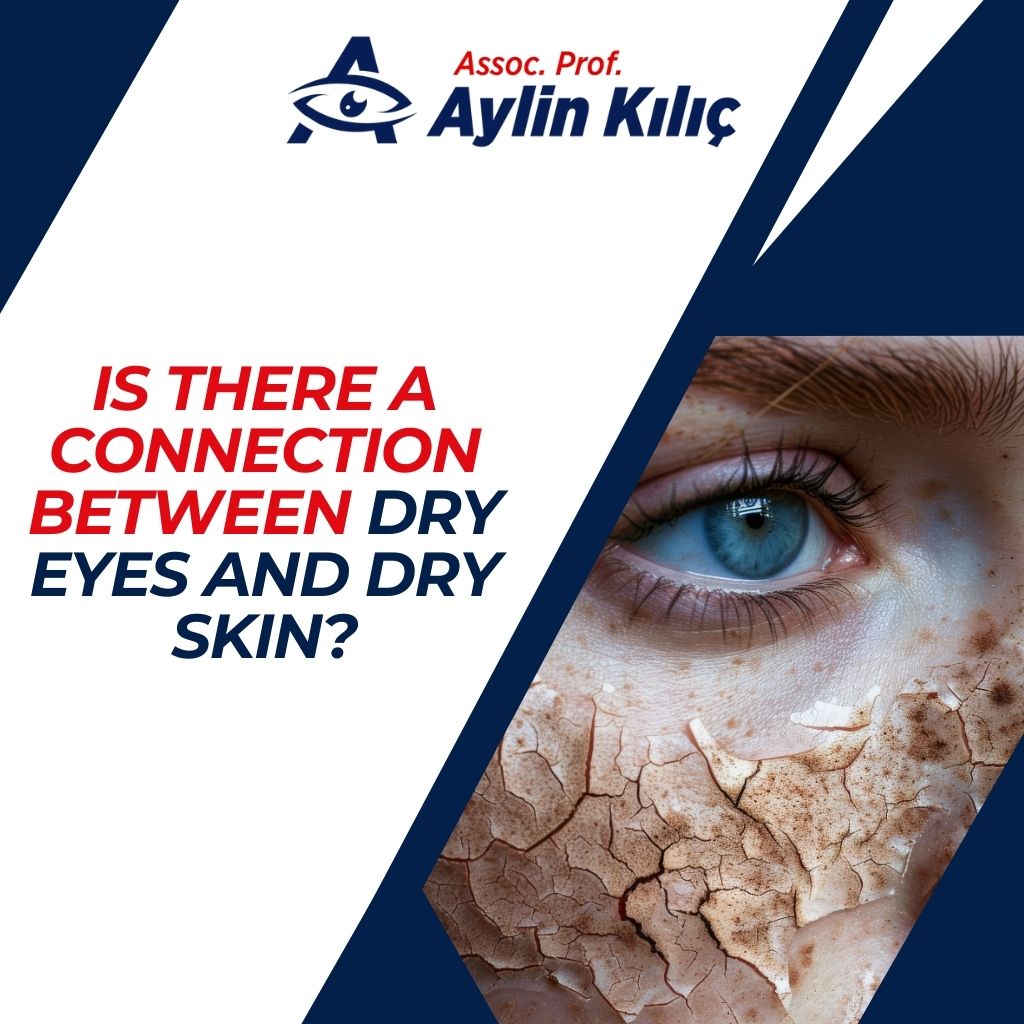 Is There a Connection Between Dry Eyes and Dry Skin