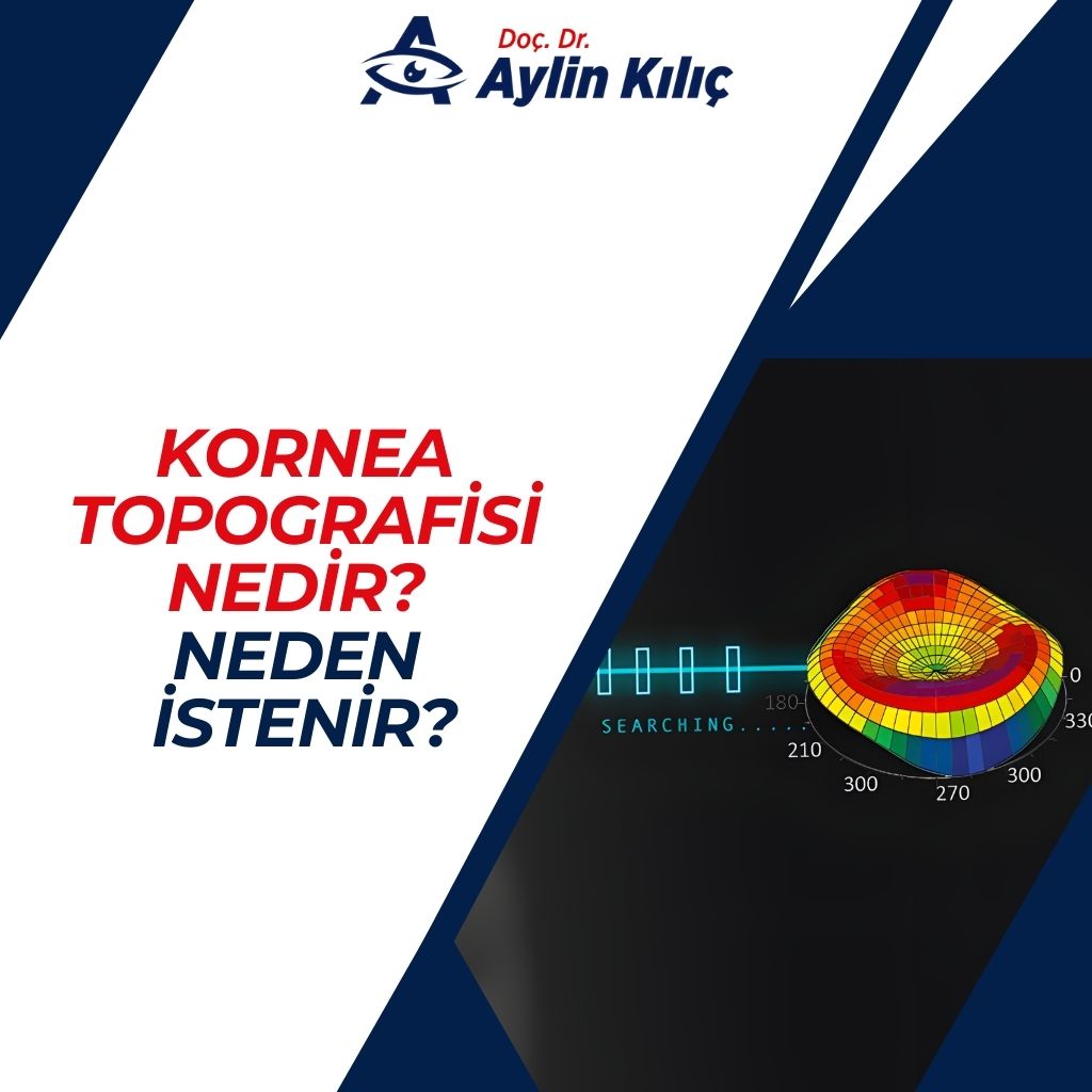 Kornea Topografisi Nedir Neden İstenir