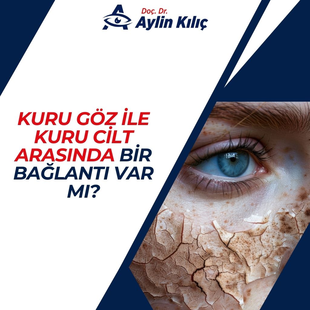 Kuru Göz ile Kuru Cilt Arasında Bir Bağlantı Var mı