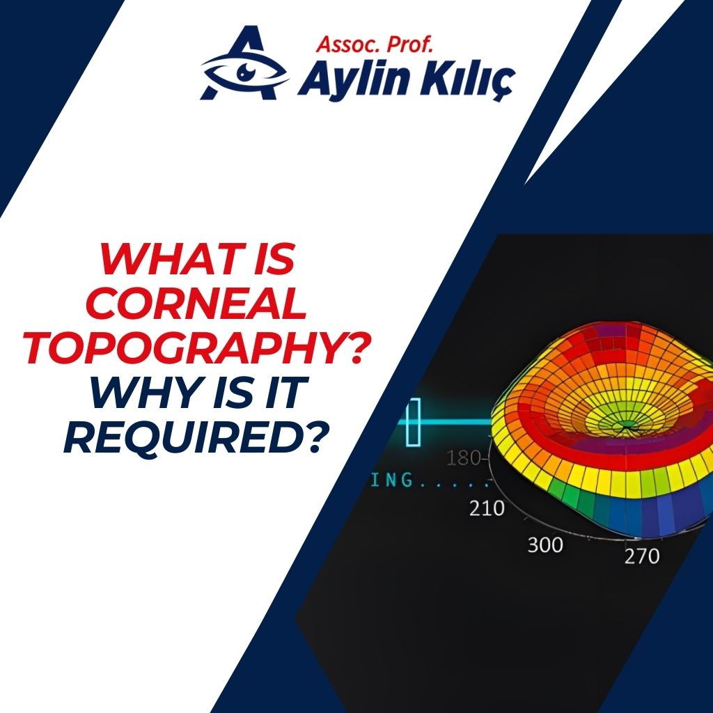 What is Corneal Topography Why is it required