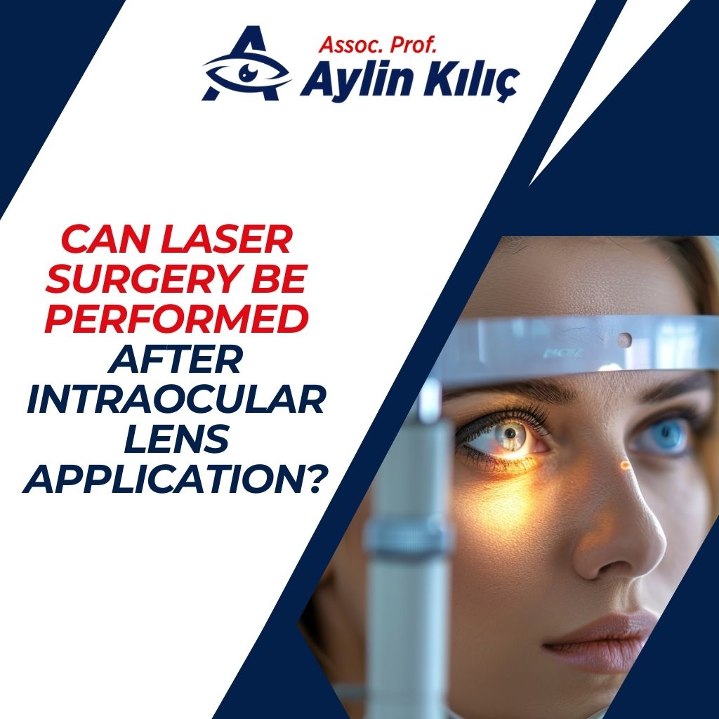 Can Laser Surgery be Performed After Intraocular Lens Application