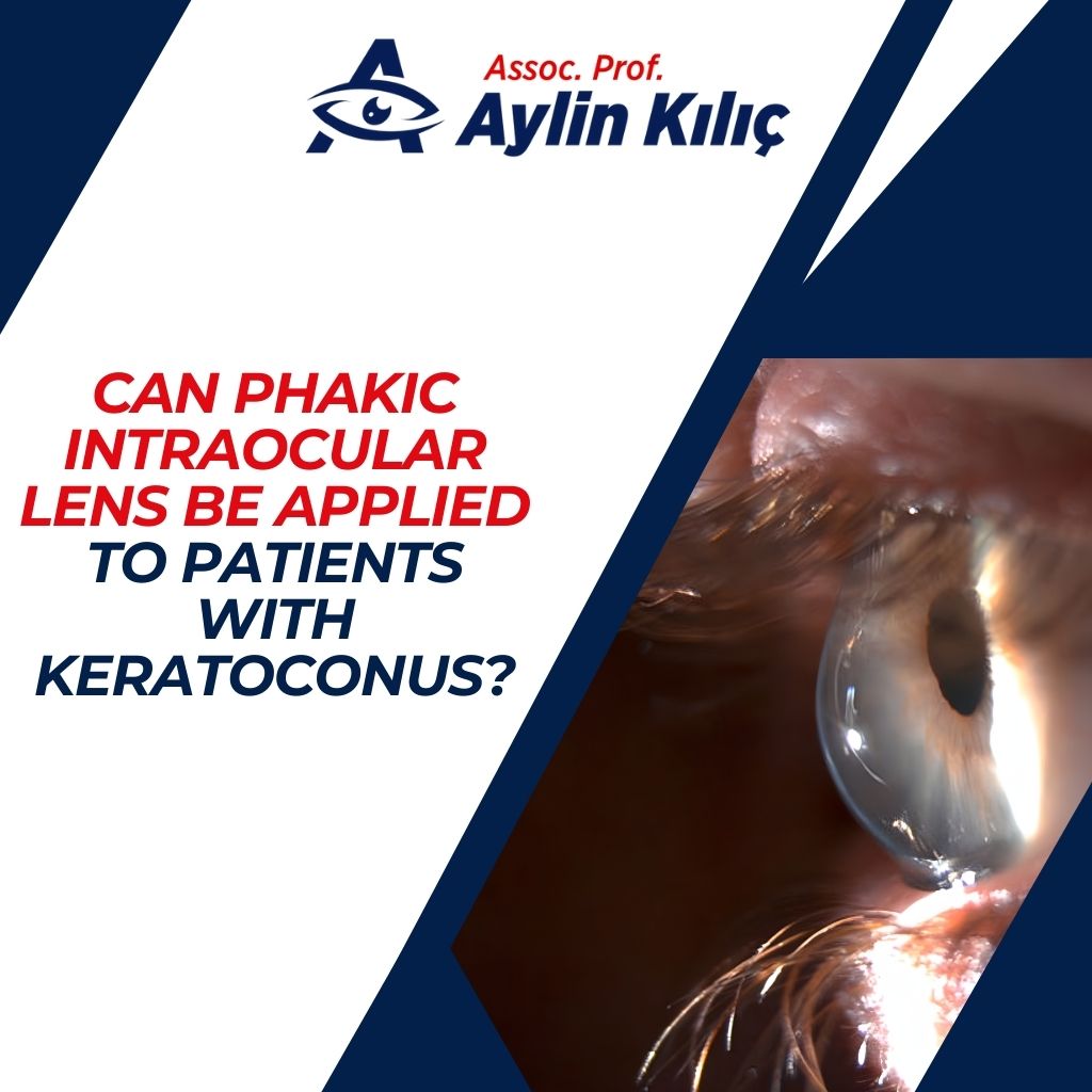 Can Phakic Intraocular Lens Be Applied to Patients with Keratoconus