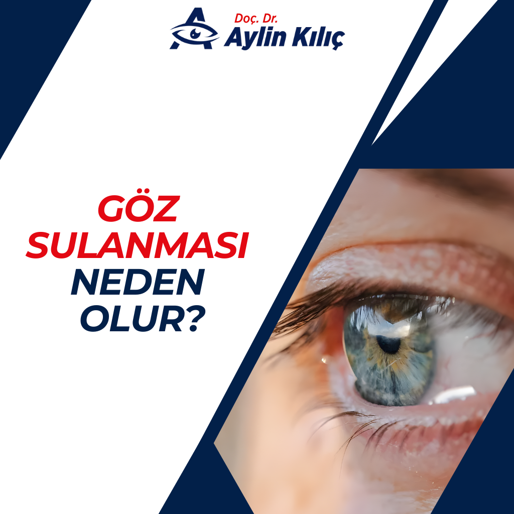 Göz Sulanması Neden Olur