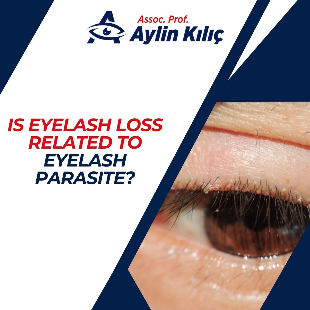 Is Eyelash Loss Related to Eyelash Parasite