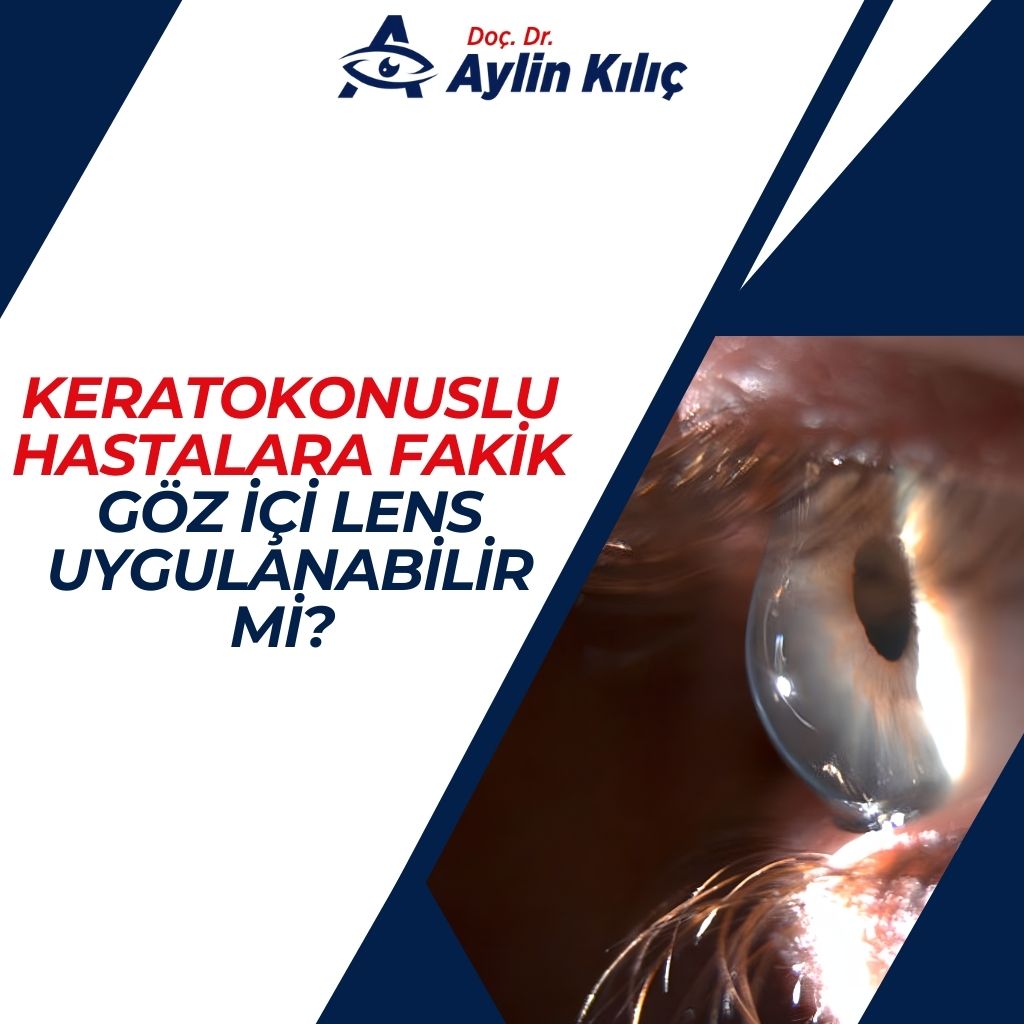 Keratokonuslu Hastalara Fakik Göz İçi Lens Uygulanabilir mi