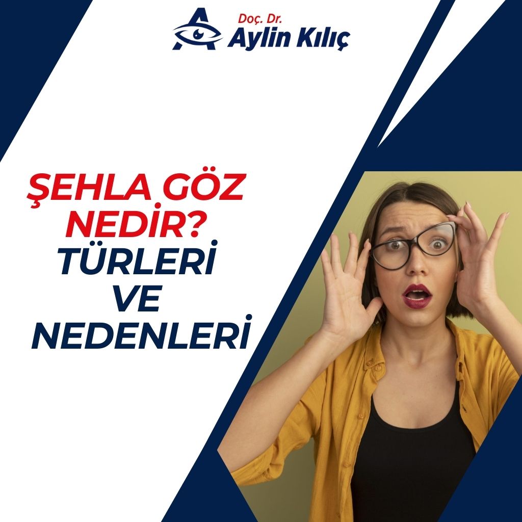 Şehla Göz Nedir Türleri ve Nedenleri