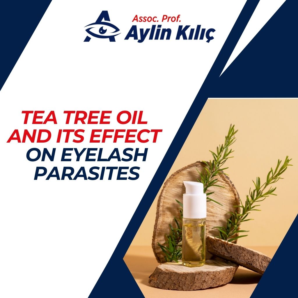 Tea Tree Oil and Its Effect on Eyelash Parasites