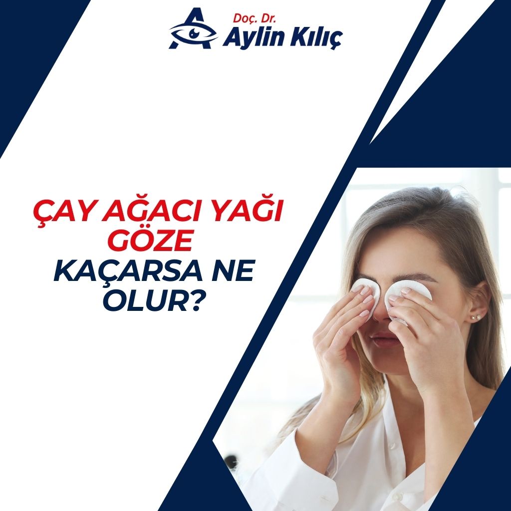 Çay Ağacı Yağı Göze Kaçarsa Ne Olur