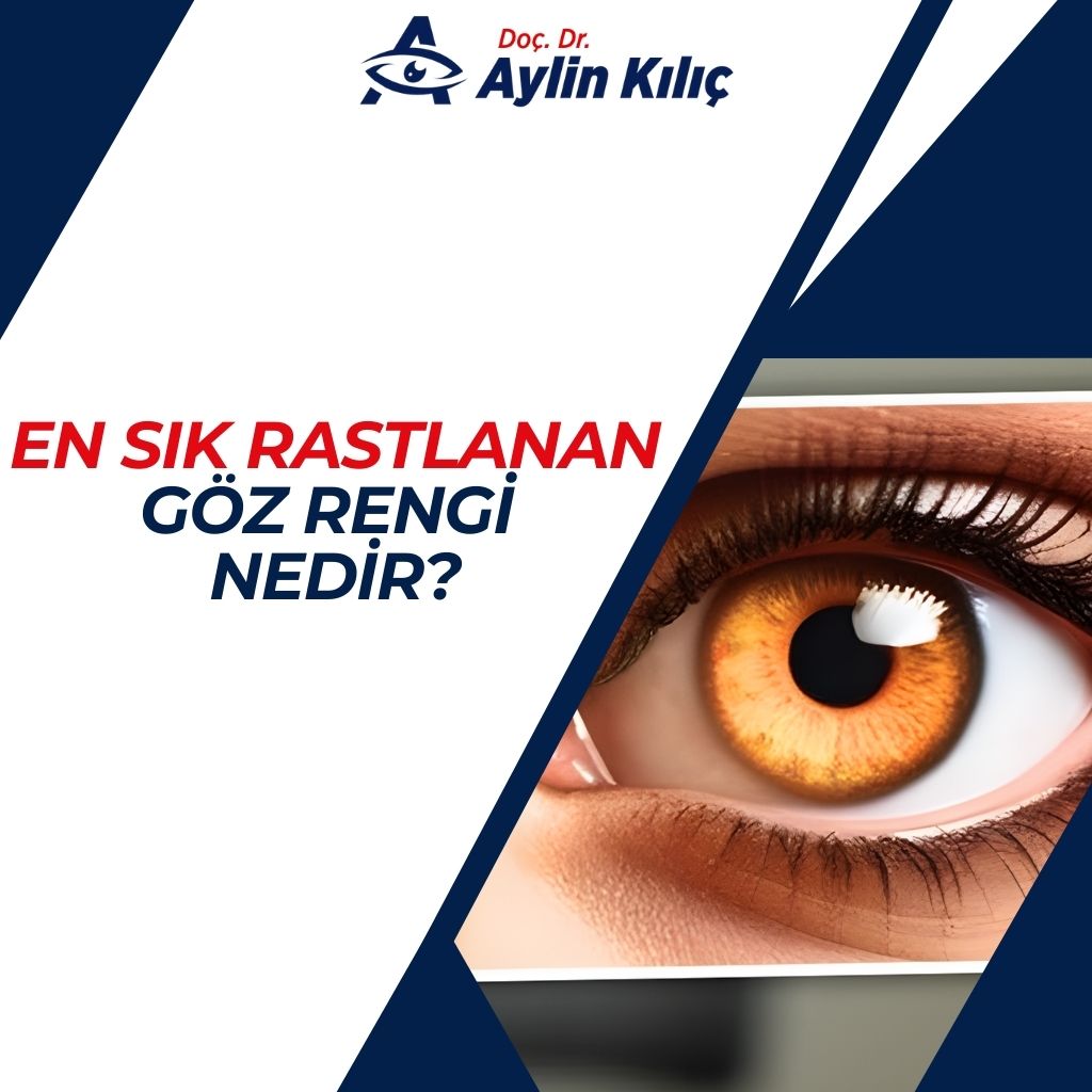 En Sık Rastlanan Göz Rengi Nedir (2)