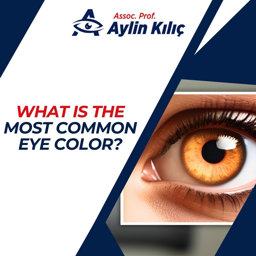 What is the Most Common Eye Color