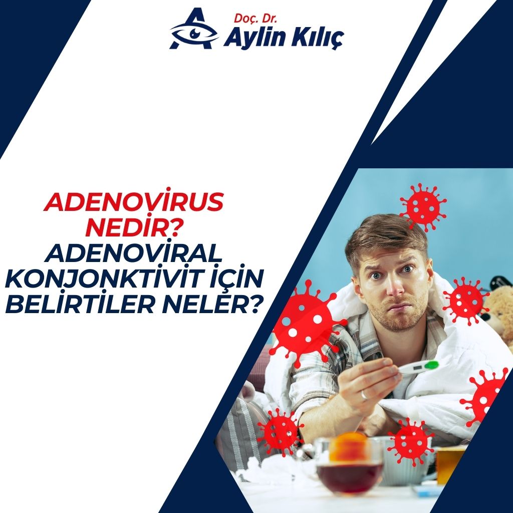 Adenovirus Nedir Adenoviral Konjonktivit için Belirtiler Neler