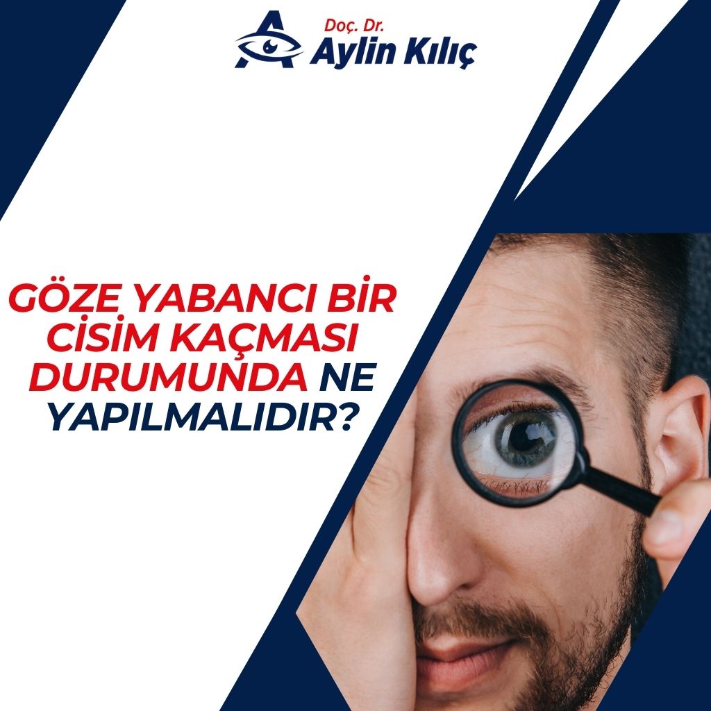 Göze Yabancı Bir Cisim Kaçması Durumunda Ne Yapılmalıdır