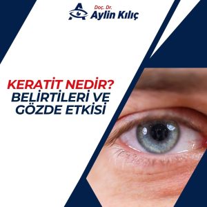 Keratit Nedir Belirtileri ve Gözde Etkisi