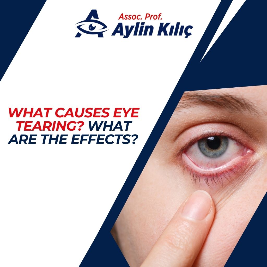 What Causes Eye Tearing What are the Effects