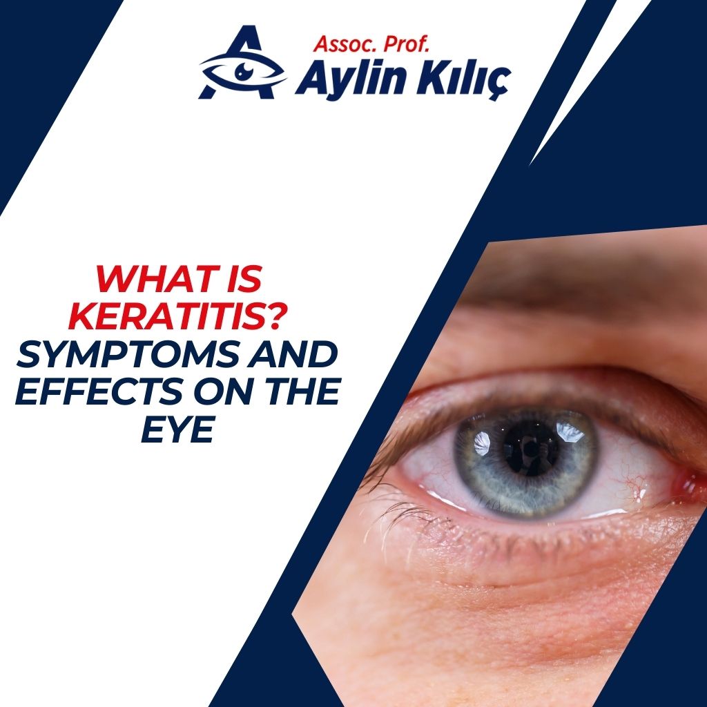 What is Keratitis Symptoms and Effects on the Eye