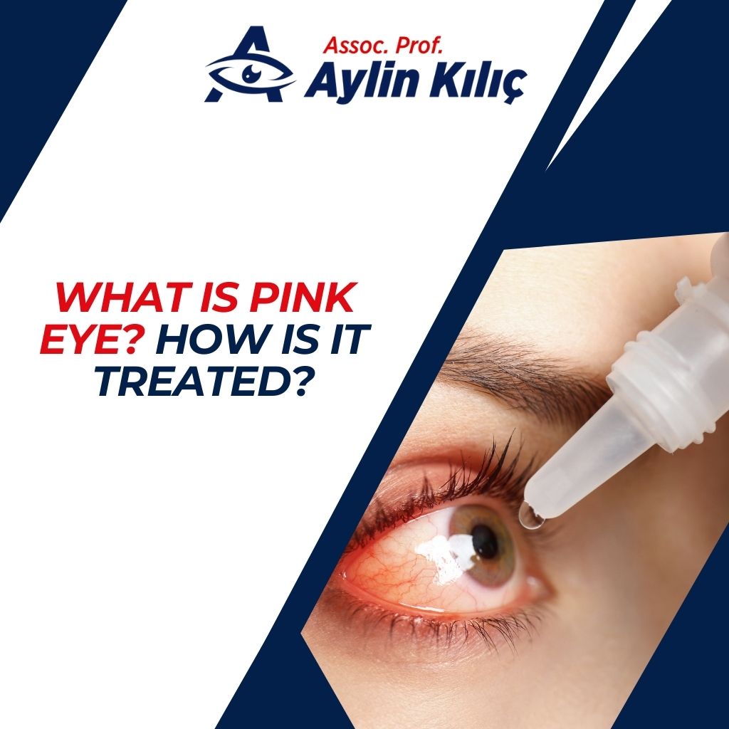 What is Pink Eye How is it treated