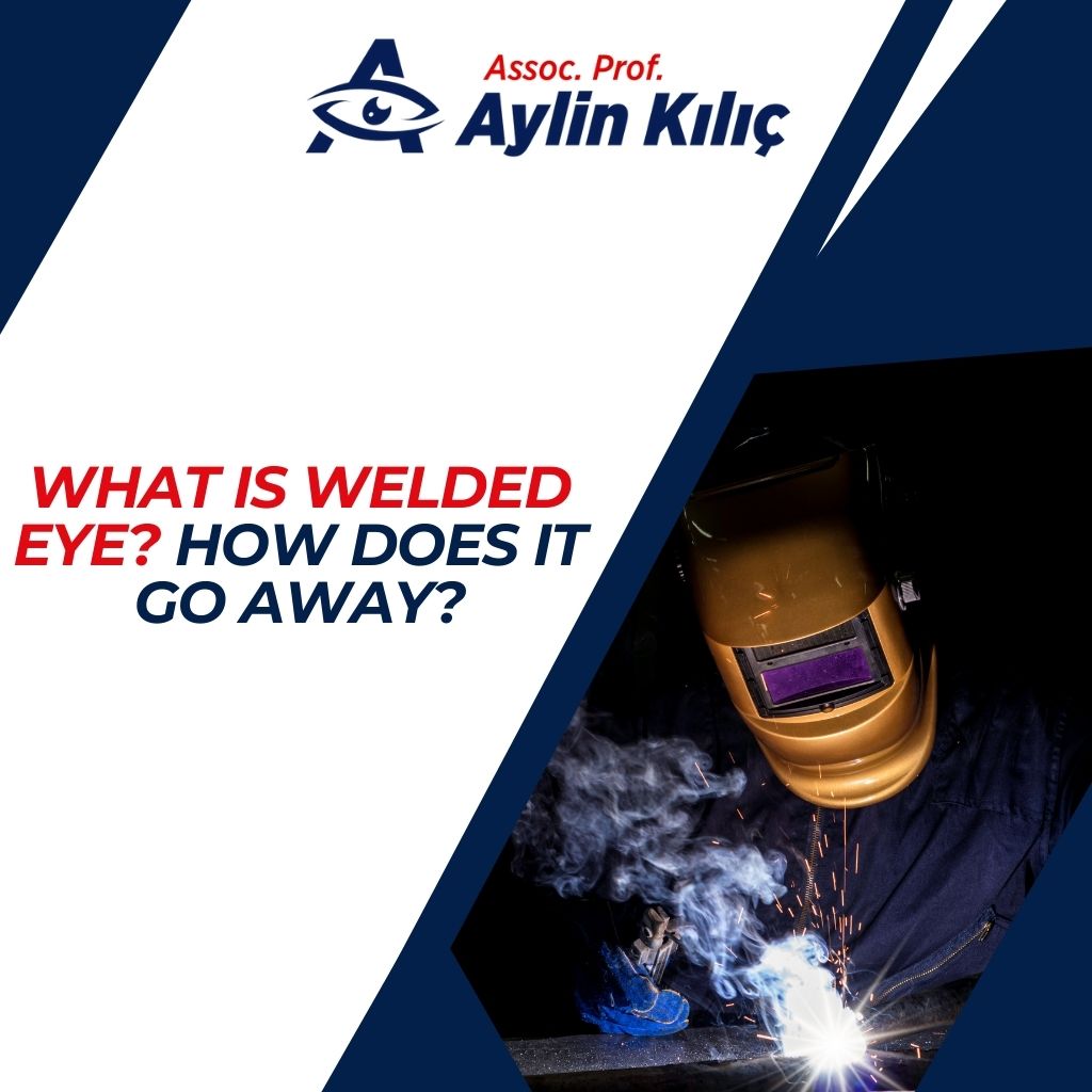 What is Welded Eye How Does It Go Away