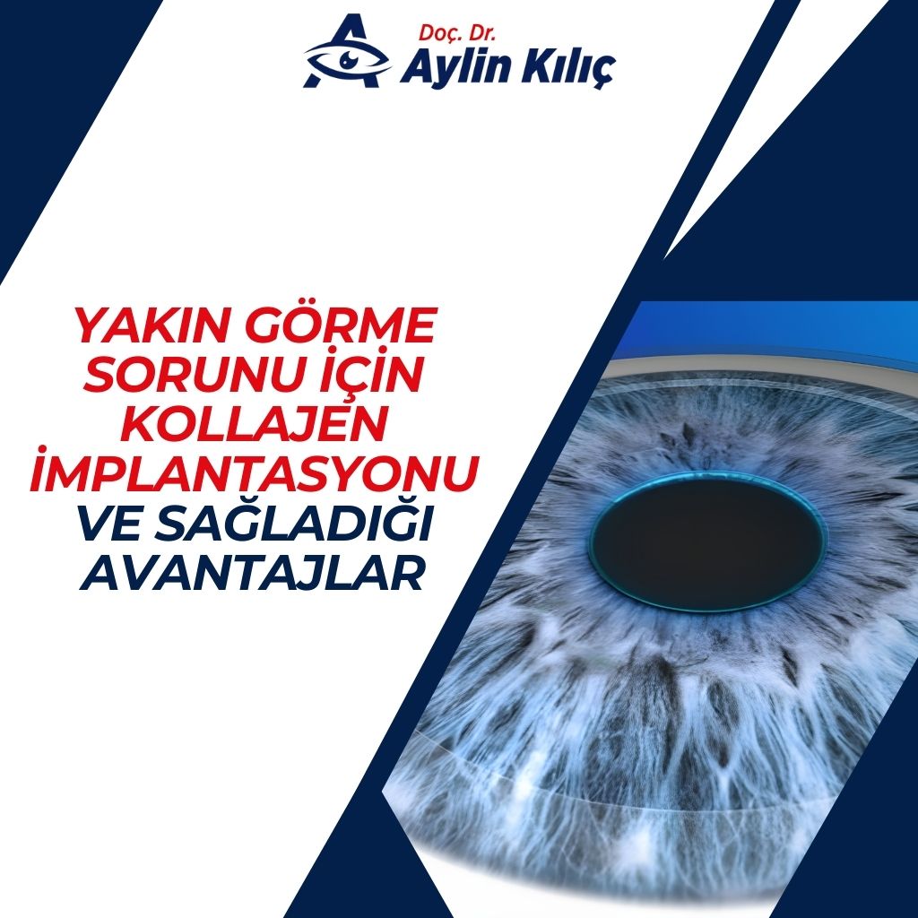 Yakın Görme Sorunu için Kollajen İmplantasyonu ve Sağladığı Avantajlar