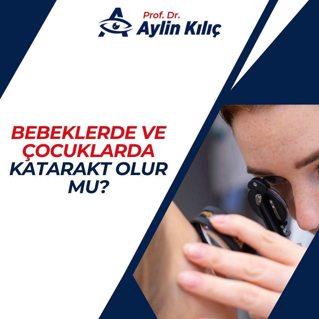 Bebeklerde Katarakt Olur mu
